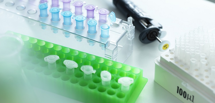 灰鑄鐵金相檢測(cè)